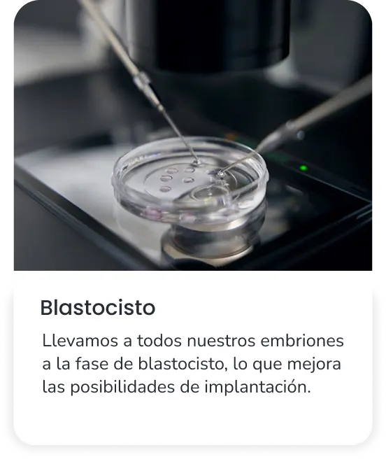 Blastocisto